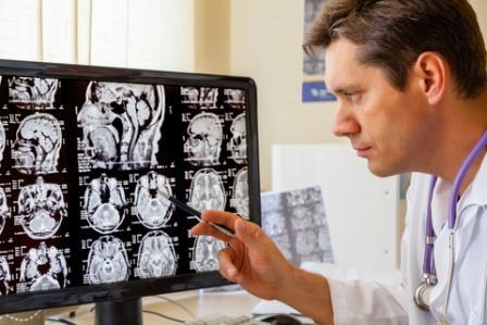 doctor examining a MRI report
