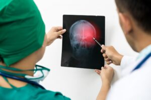 Doctors examining xray of patient's brain injury.