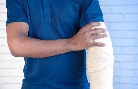 Broken Bones Injury