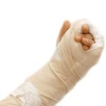 broken arm personal injury